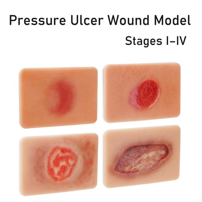#ad Decubitus Ulcer Wound Care Model Bedsores Model Pressure Injury Model $125.99