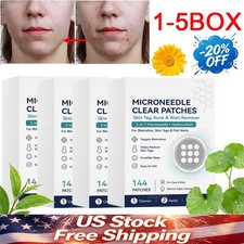 2-in-1 Microneedle Patches 144pcs, Skin Tag Wart Acne Remover Patches US STOCK