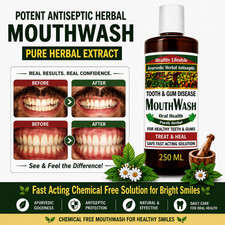 Tooth & Gum Disease Treatment Bad Breath Pyorrhea Cure - Herbal MouthWash 250 ML