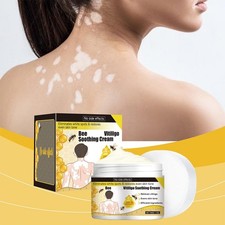 Bee Vitiligo Soothing Cream D3H7 GTR8 GTR7 V7V7 SBC QDK USN EDF
