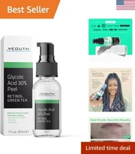 Glycolic Acid 30% Peel - Exfoliating Gel with Retinol & Green Tea, 1oz