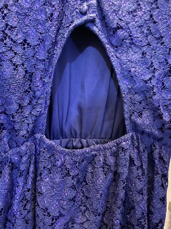 Mini Vestido Dolce Vita Azul Encaje Talla Xs Como Nuevo Foto 3 de 4