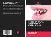 Efeitos DA Saliva Sobre OS Fios OrtodÔNticos. Mariyam Zehra