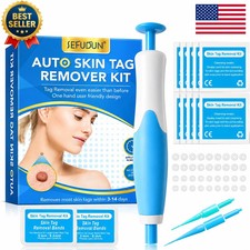 Auto Micro Skin Tag Remover Device Kit Safe Painless Removal 2-8 mm Band Tool