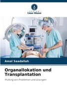 Organallokation Und Transplantation Amal Saadallah