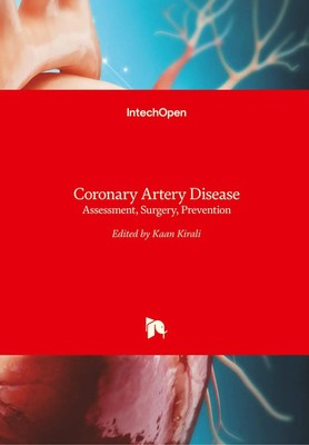 Kaan K¿rali | Coronary Artery Disease | Buch | Englisch (2015) | 314 S.