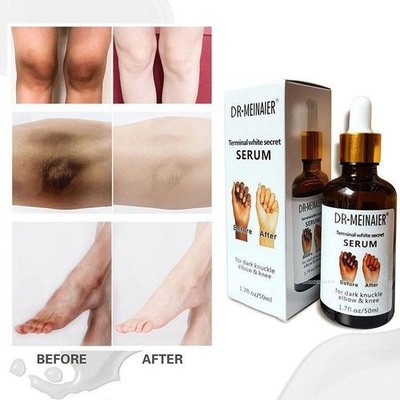 Strong Whitening Dark Skin Knuckles Feets Knees Elbows Armpit inner Thigh Serum