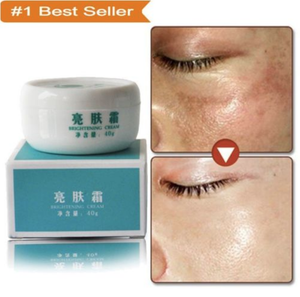 forehead darkness removal cream