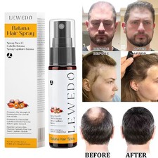 Batana Oil Hair Growth Spray Anti Hair Loss Fast Regrowth Scalp Treatment Serum