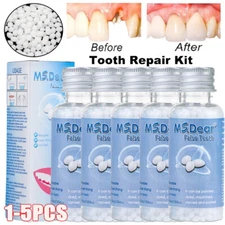 Tooth Repair Beads Granules Temporary Tooth Glue Reusable Moldable False Teeth