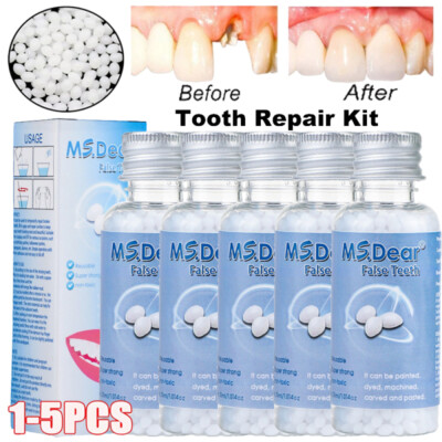 Tooth Repair Beads Granules Temporary Tooth Glue Reusable Moldable False Teeth
