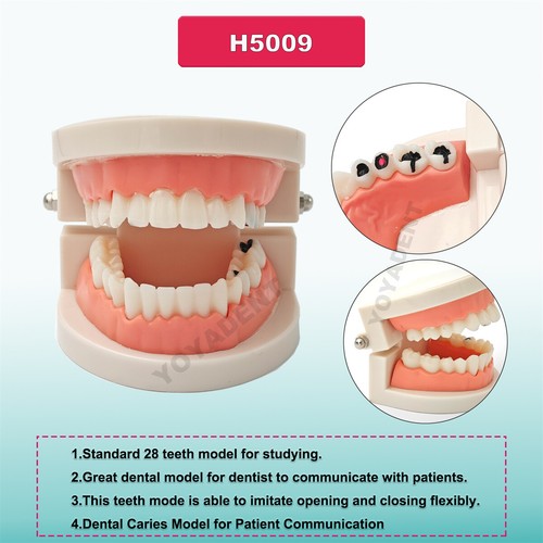 Multiple Types Dental Teeth Model Ortho Implant Practice Teaching Demo Model - Picture 232 of 276