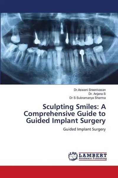 Sculpting Smiles: A Comprehensive Guide To Guided Implant Surgery Taschenbuch-image