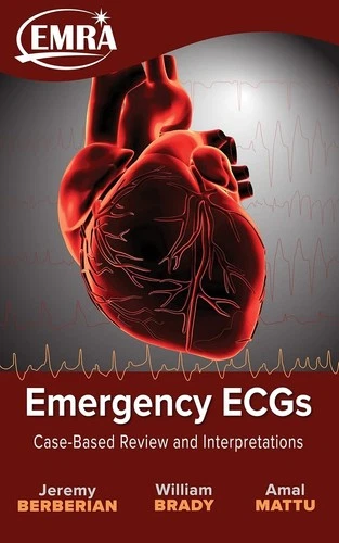 Emergency ECGs: Case-Based Review & Interpretations - EMRA - Paperback