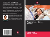 RegeneraçãO óSsea Guiada Chandni Batra