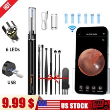   Ear Wax Removal Camera Ultra-HD Ear Wax Remover Tool, Ear Cleaner Washer kits