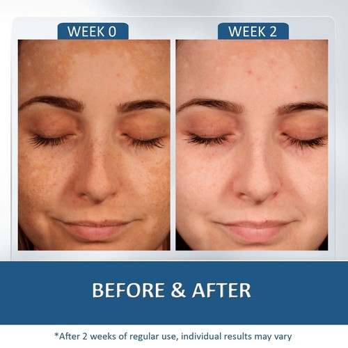 Wrinkle Remover Instant Face Retinol Cream Anti-Aging Skin Tightening Firming - Picture 8 of 9