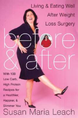 Before and After: Living and Eating Well After Weight Loss Surgery - VERY GOOD