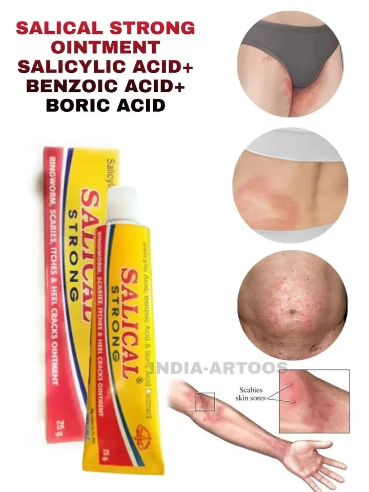 SEIFE & SALBE COMBO KIT FÜR KRÄTZE MILBEN & EIER KOMPLETTE AUSROTTUNG KOSTENL... - Bild 2 von 4