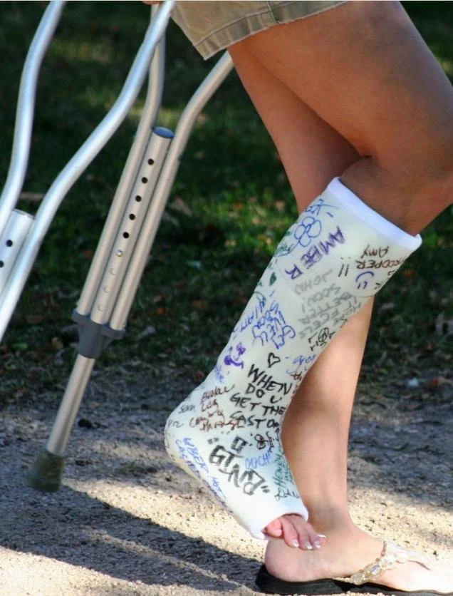 Fiberglass Short Leg Cast Kit | Orthopedic Casting Material | Broken Leg / Ankle - Image 2 of 4