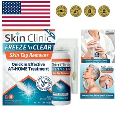 Skin Tag Remover - Cryogenic Kit with 8 Precision-Tip Applicators  Tweezers ...