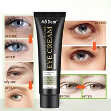 Temporary Eye Tightener Eye Cream, Instant Reduces Under-Eye Bags, Dark Circles 