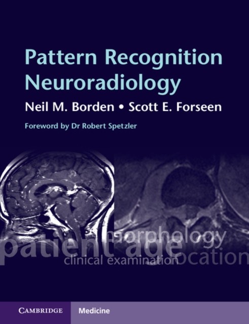 Pattern Recognition Neuroradiology by Neil M. Borden, Scott E... - 9780521727037 - Image 4