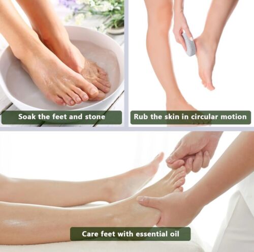 Natural Foot Pumice Stone for Feet, Borogo 2-Pack Lava Pedicure Tools Hard Sk... - Picture 3 of 5