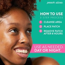 Peach Slices Deep Blemish Microdarts