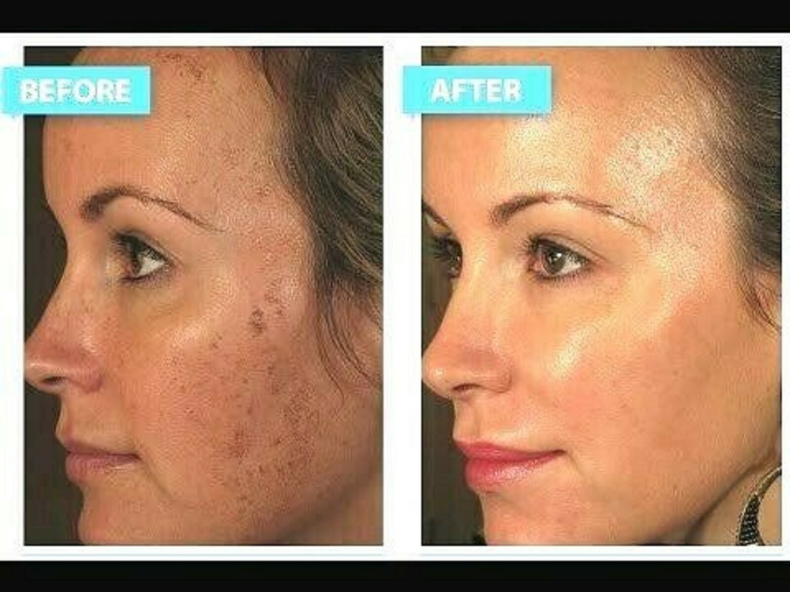 even tone correcting serum