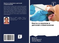 Kisty I Opuholi W Detskoj Stomatologii Veena B