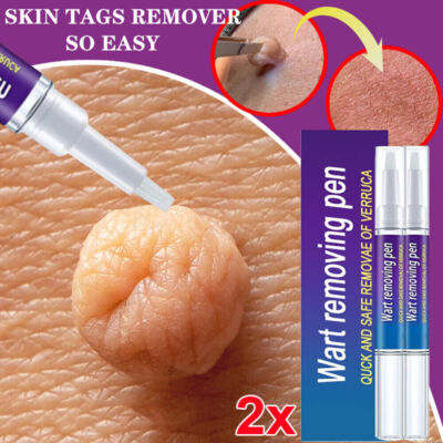 #ad 2PACK 12 Hours Wart Remover Pen Skin Tag Mole Remover Eliminate Foot Corn Warts $10.85
