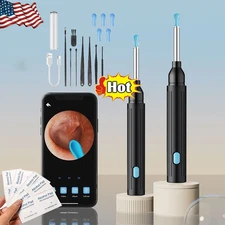 Ear WEar Wax Removal Tool Camera, Ear Cleaner, Ear Scope, Earwax Removal Kit US