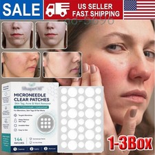 144Patches MICRONEEDLE CLEAR PATCHES For Skin Tag, Acne  Wart Remover US