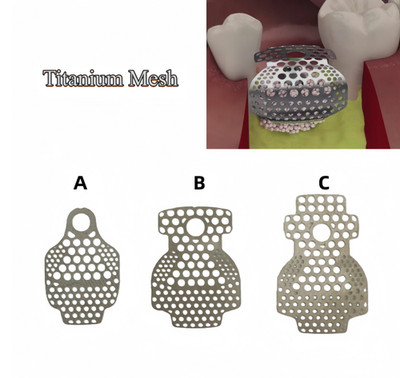 Dental GBR Titanium Mesh Membrane Guided Regeneration Plate Flexible