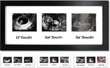 IHEIPYE Triple Sonogram Pregnancy Frame   Baby Ultrasound Picture Frame with
