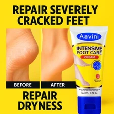 Aavini Foot Cream 50g – Repairs Cracked Heels, Deeply Moisturizes & Fights Odor