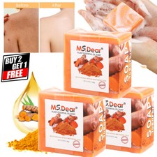 Dark Spot Remover Whitening Soap Tumeric Face  Body lightening Acne Brightening