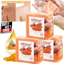 Dark Spot Remover Whitening Soap Tumeric Face & Body lightening Acne Brightening