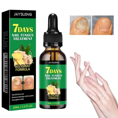 ANGEL SILK Fungal Nail Treatment Nail Fungus Treatment for Toenail (30ML)