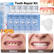 Strong Teeth Tooth Repair Temporary Dental Cement Cavity Filling Kit Fake Teeth,