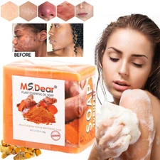 3-1X Tumeric Soap Skin Whitening Dark Spots lightening Acne Brightening Turmeric