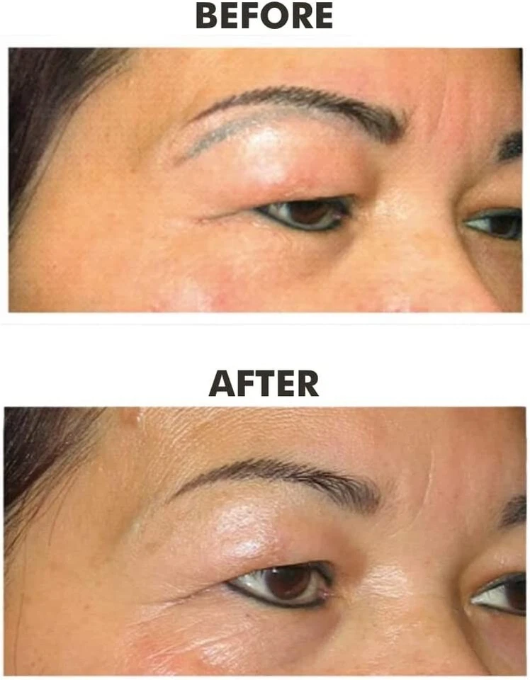 Removedor de tinta de pigmento no deseado Biotouch COLOR LIFT Microblading 1 oz Foto 3 de 4