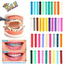 1040 Pcs Dental Orthodontic Ligature Ties Elastic Rubber Bands Colors RA