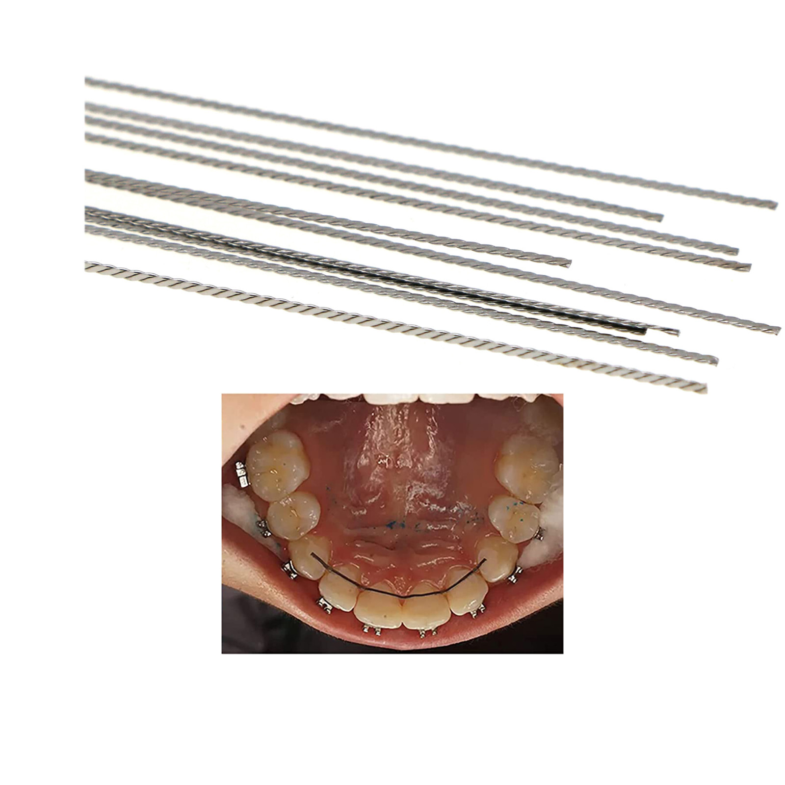 US Dental Orthodontic Stainless Steel Lingual Retainer Wire Twist