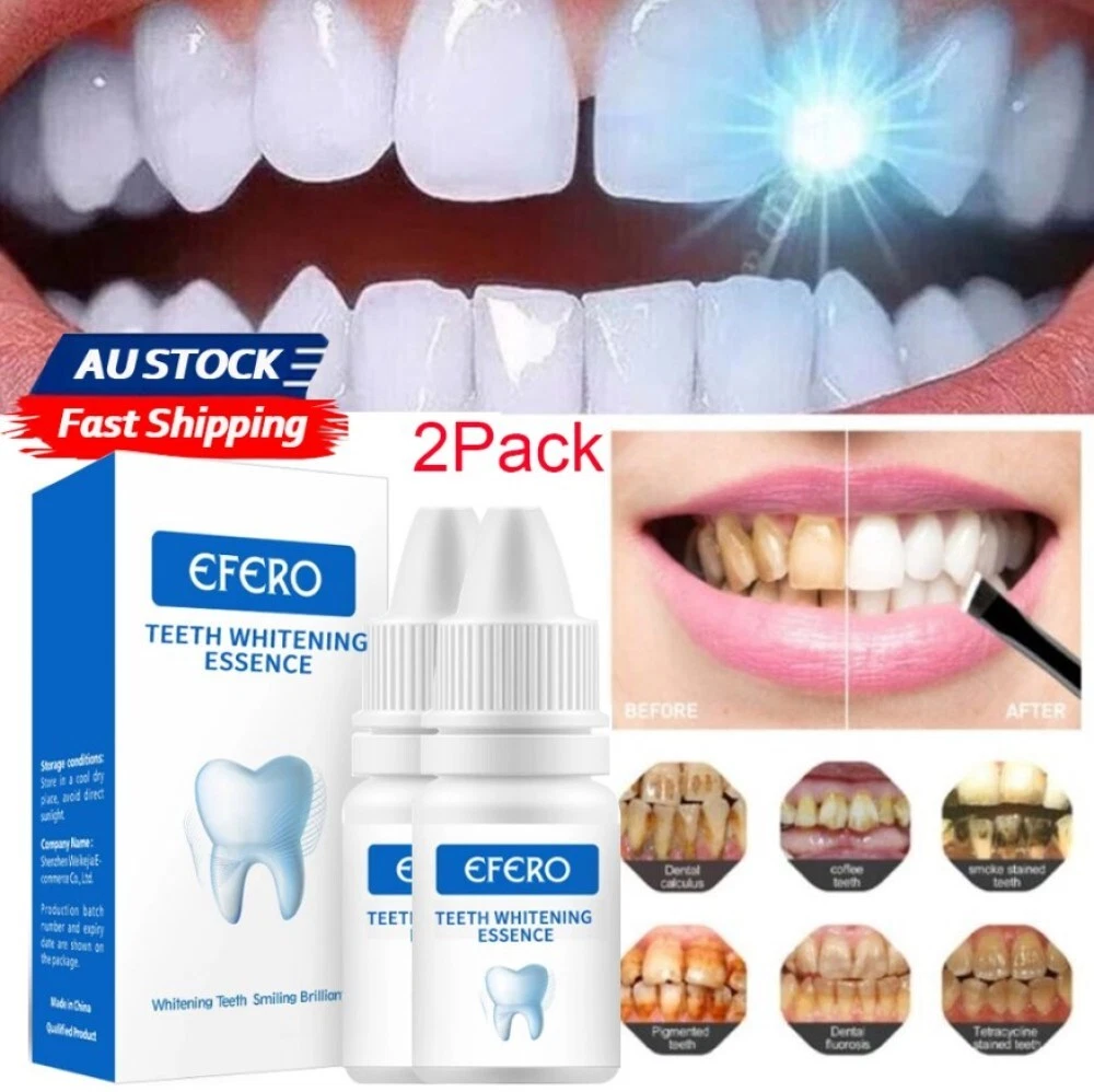 Efero Teeth Whitening Essence 10ml Price In Nigeria Konga, 47 OFF