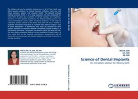 Reeta Jain (U. A.) | Science Of Dental Implants | Taschenbuch | Englisch (2011)