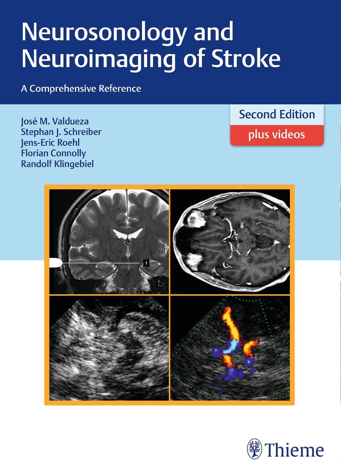 Thumbnail - Neurosonology And Neuroimaging Of Stroke, José Manuel Valdueza