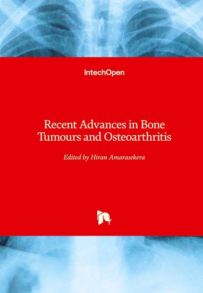 Hiran Amarasekera | Recent Advances In Bone Tumours And Osteoarthritis | Buch-image