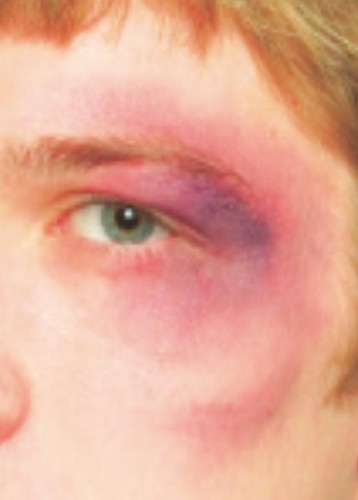 Mehron Pro FX Bruise Wheel MUA Fx efecto especial TV actor teatro maquillaje - Imagen 12 de 20